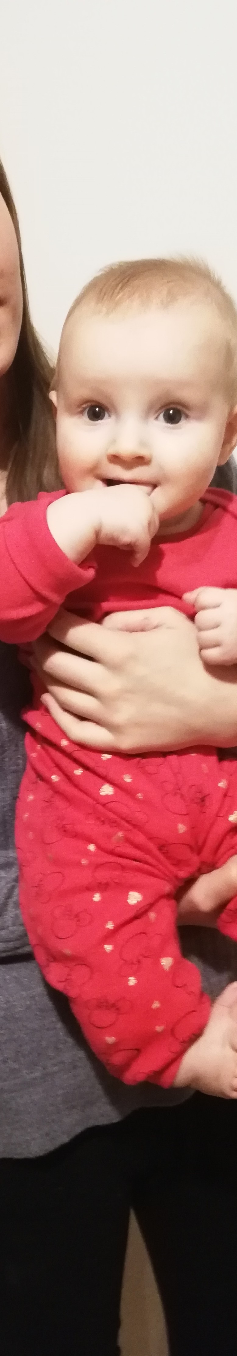 Nie zostawimy Marcelinki bez pomocy. Zbieramy na operację nóżki.